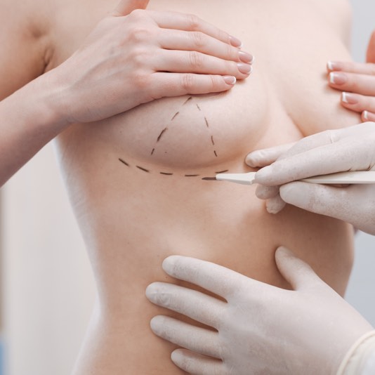 choose-a-breast-reconstruction-professional-you-can-trust