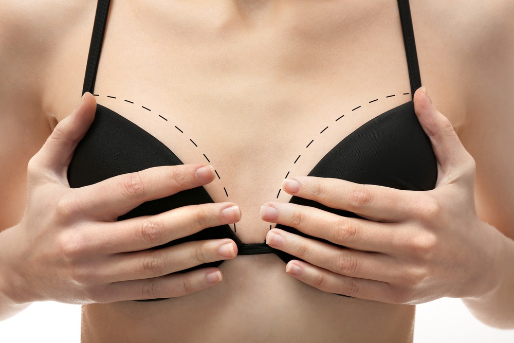 Breast Augmentation Recovery Stages