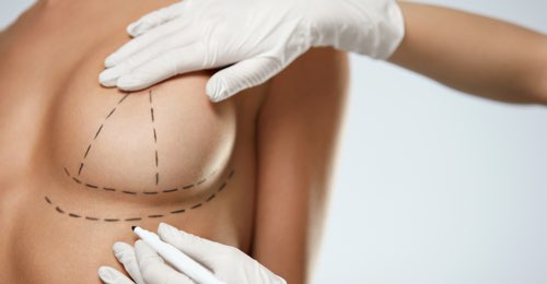 Breast lift surgery in houston