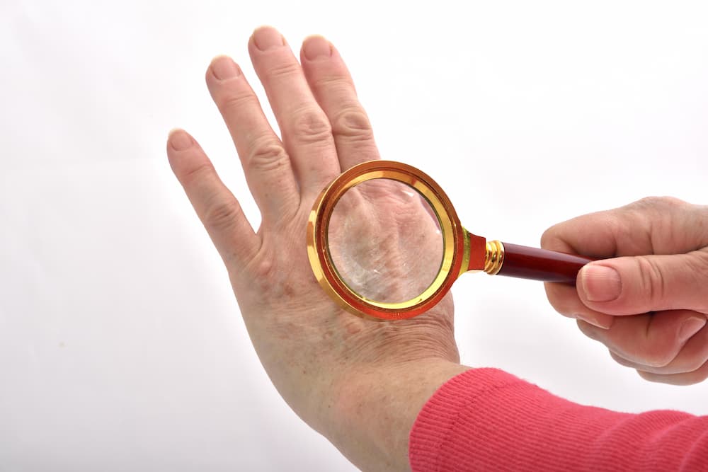 Woman holding a magnifying glass to her hand skin